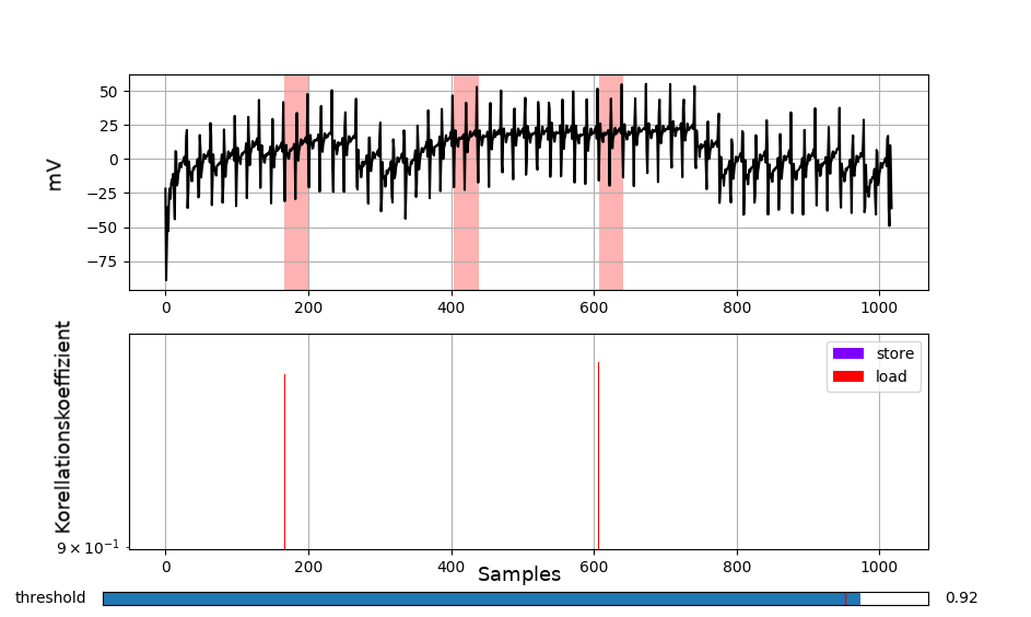 series of ALU instructions correlated with the templates of memory instruction